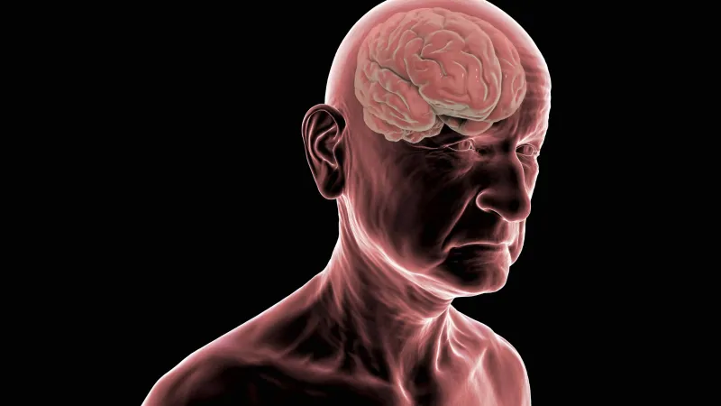 Alzheimer'da Erken Teşhis Hayat Kurtarıyor! İşte Belirtileri
